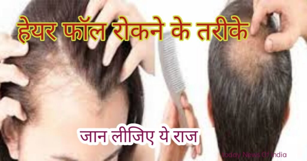 हेयर फॉल रोकने के तरीके